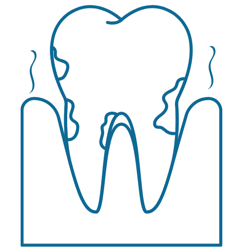 Periodontal therapy | Best adult and pediatric dentist for fillings, gum disease, root canals, and bridges | Temecula CA