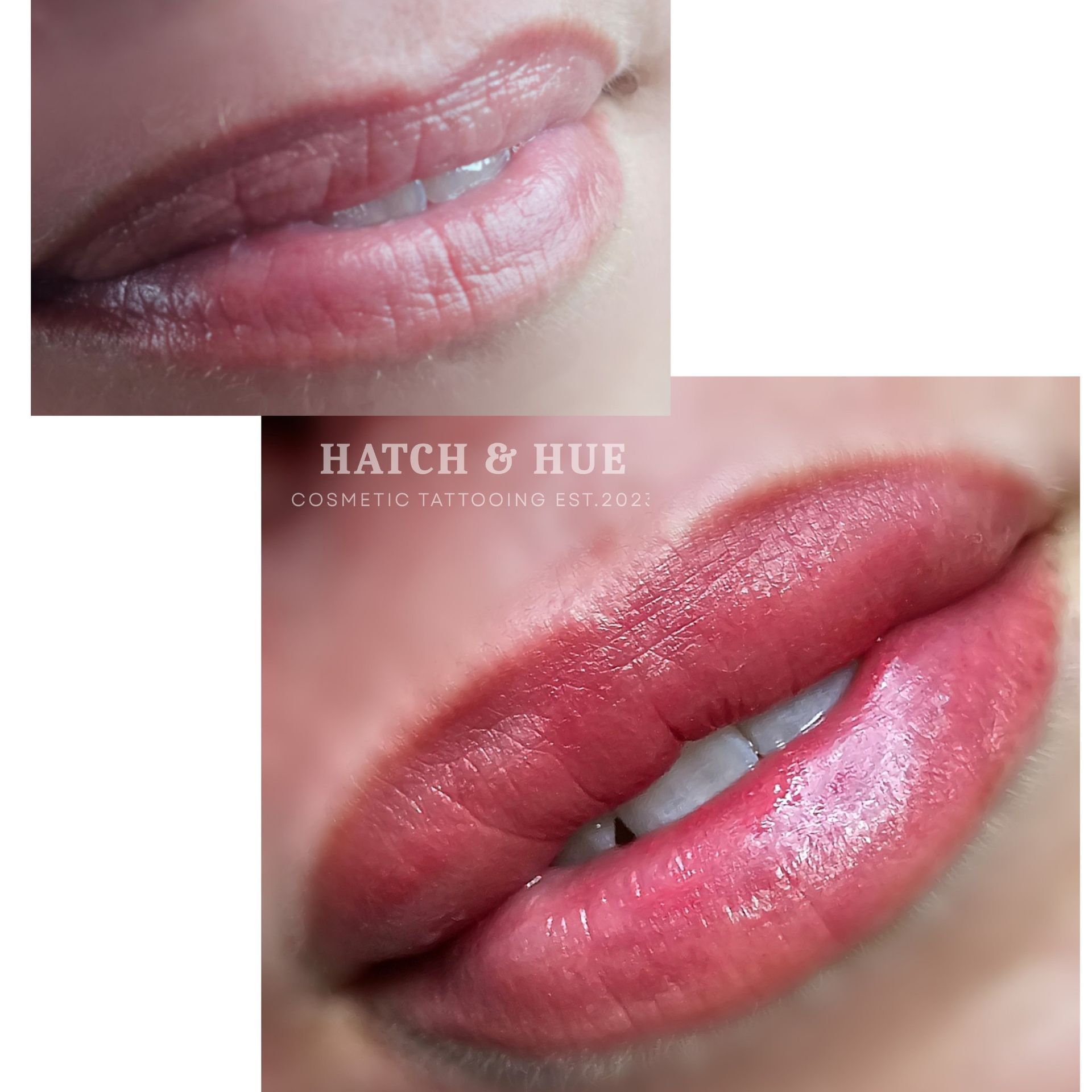 Before and after photos of lips, with enhanced color and fullness in the