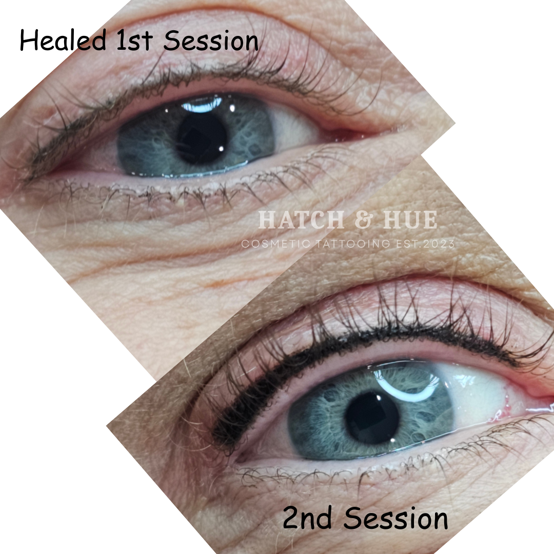 Comparison of an eye with eyeliner. Top: healed first session. Bottom: second session.