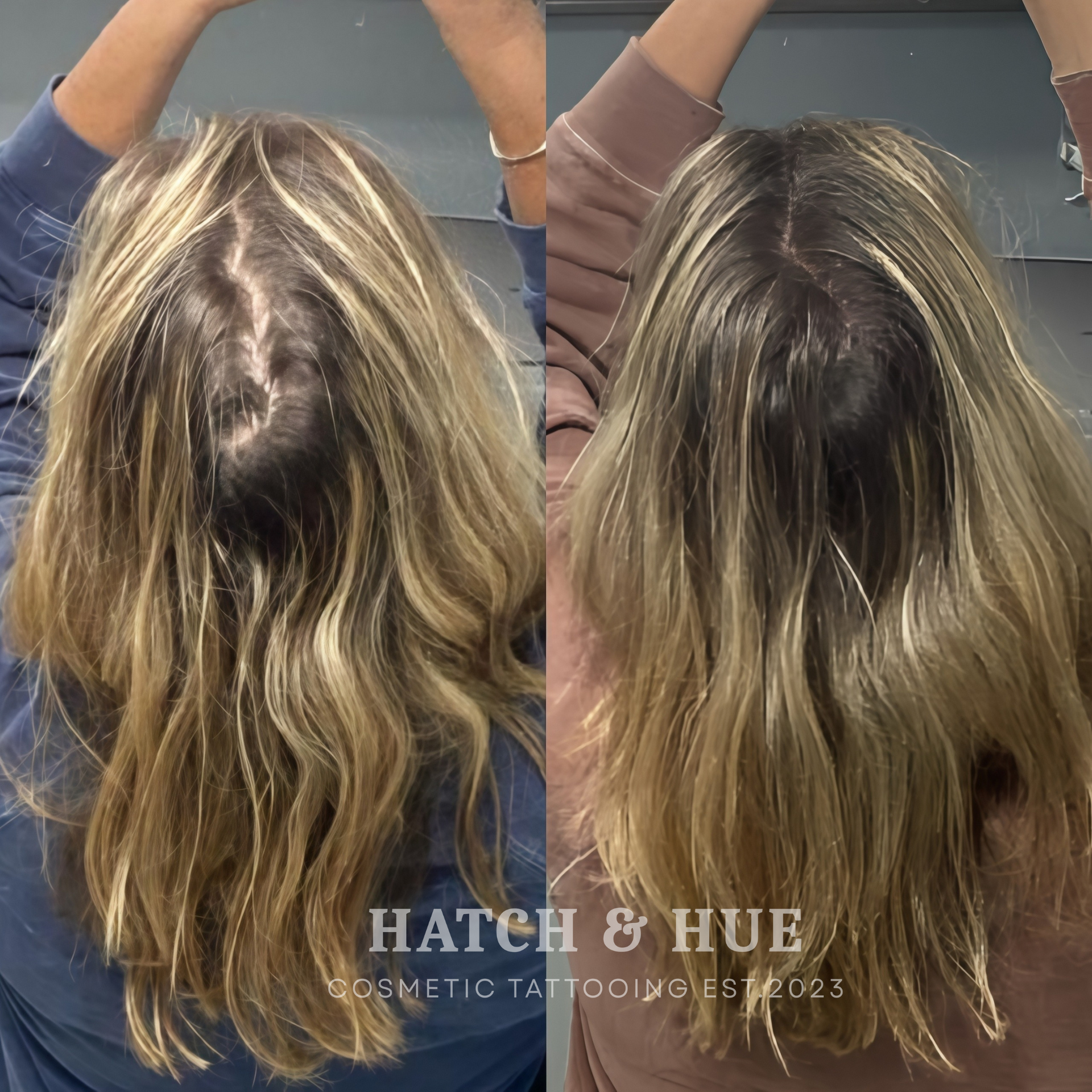 Before-and-after scalp micropigmentation showing hair loss improvement, with blonde hair.