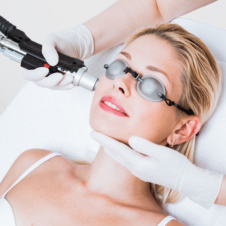 Laser Facials