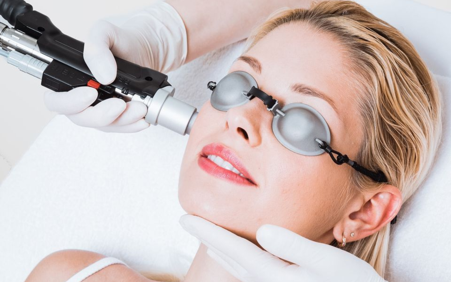 Laser Facials