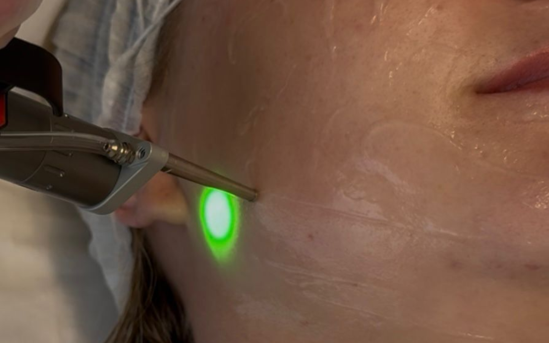 Skin rejuvenation