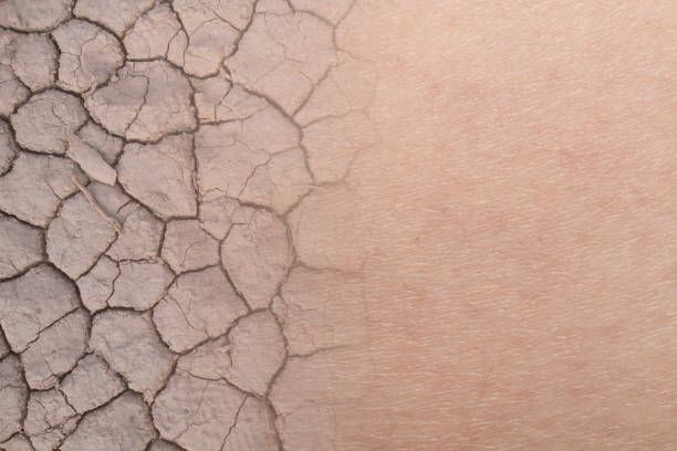 A close up of a cracked surface on a person 's skin.