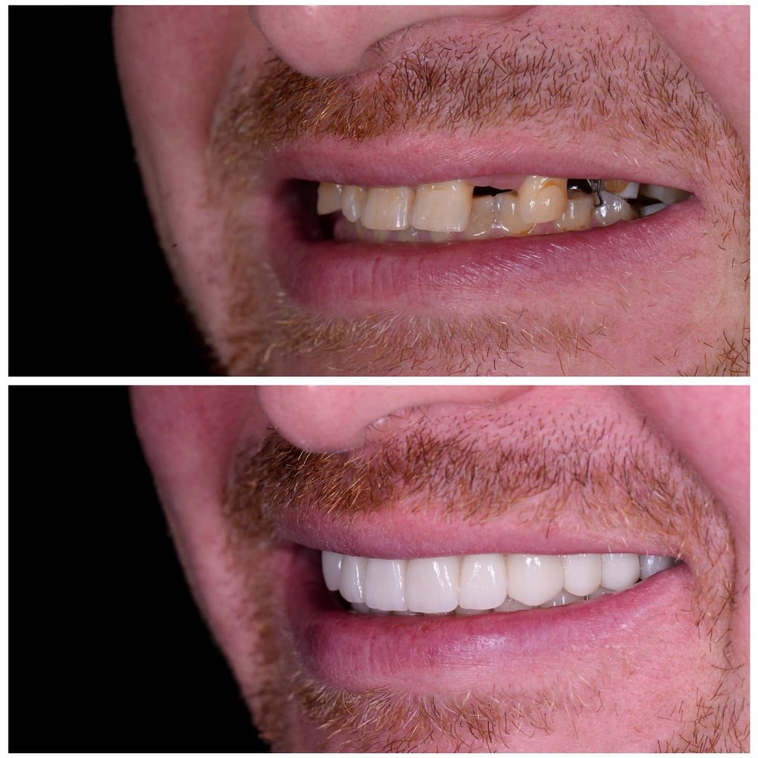 SMILE GALLERY - TLC Dental Wellness