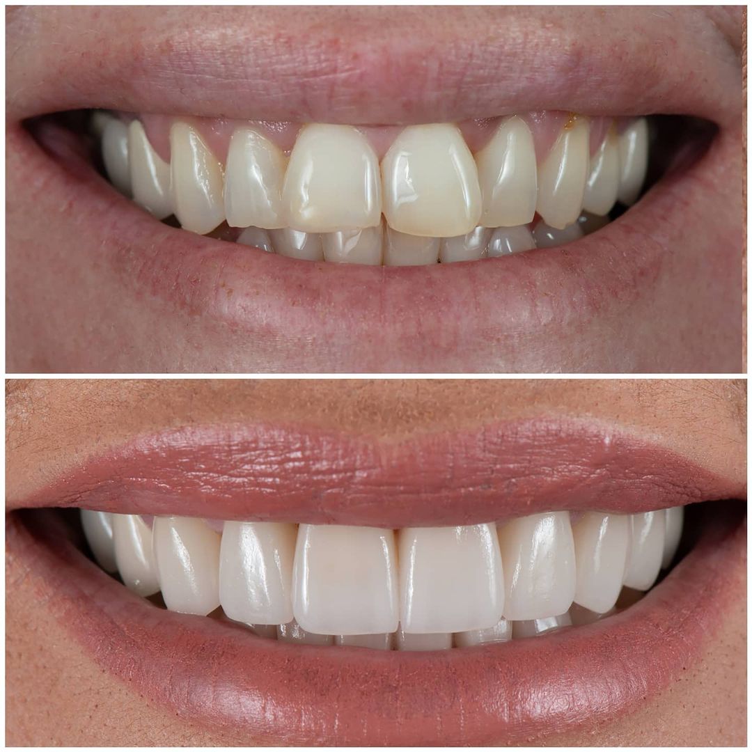 SMILE GALLERY - TLC Dental Wellness