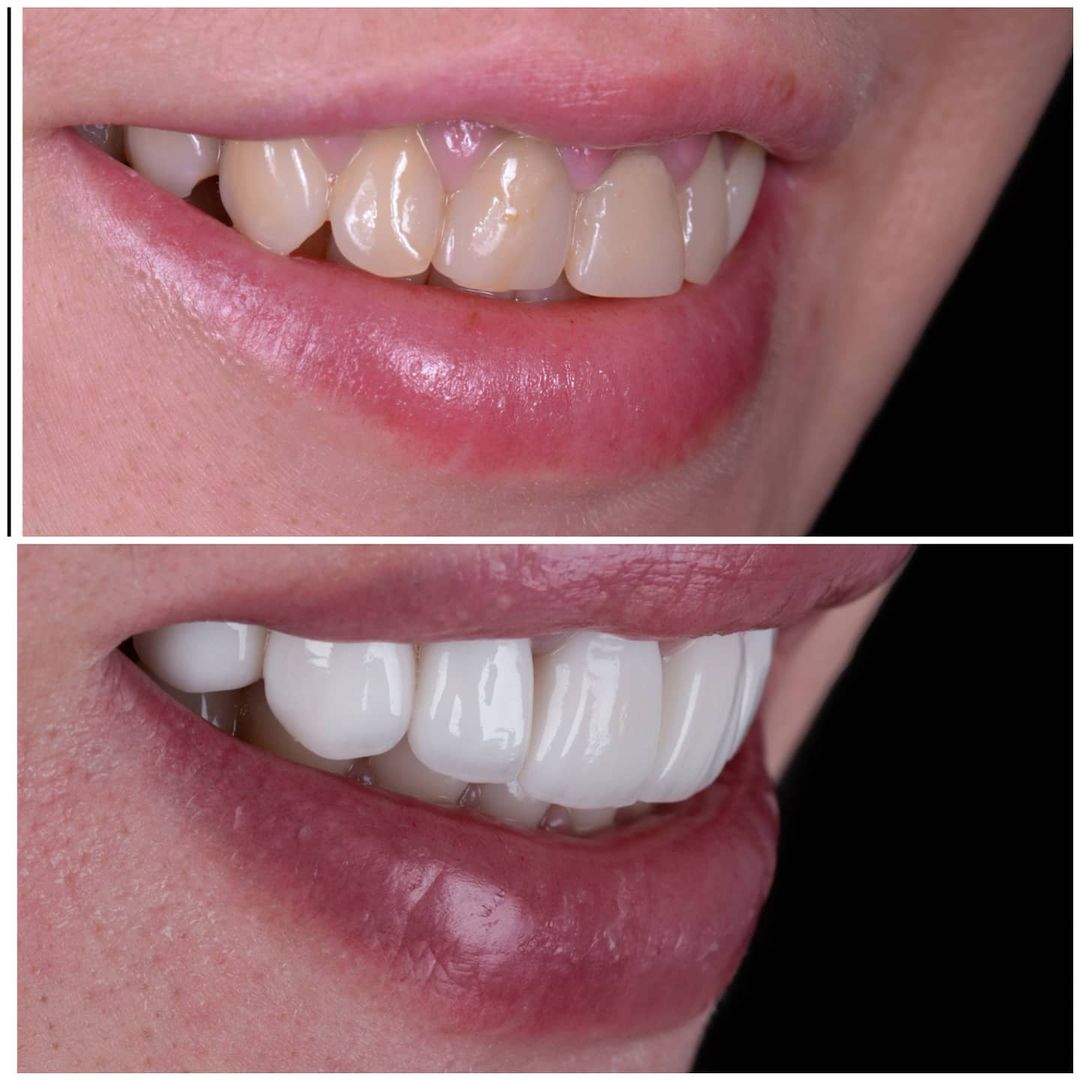 SMILE GALLERY - TLC Dental Wellness