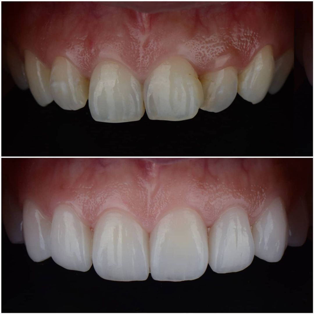 SMILE GALLERY - TLC Dental Wellness