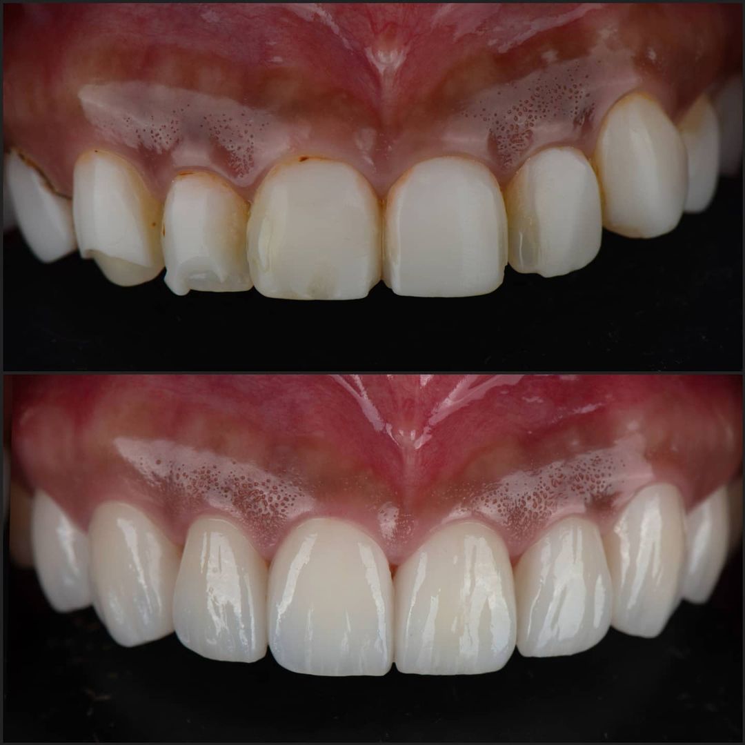 SMILE GALLERY - TLC Dental Wellness