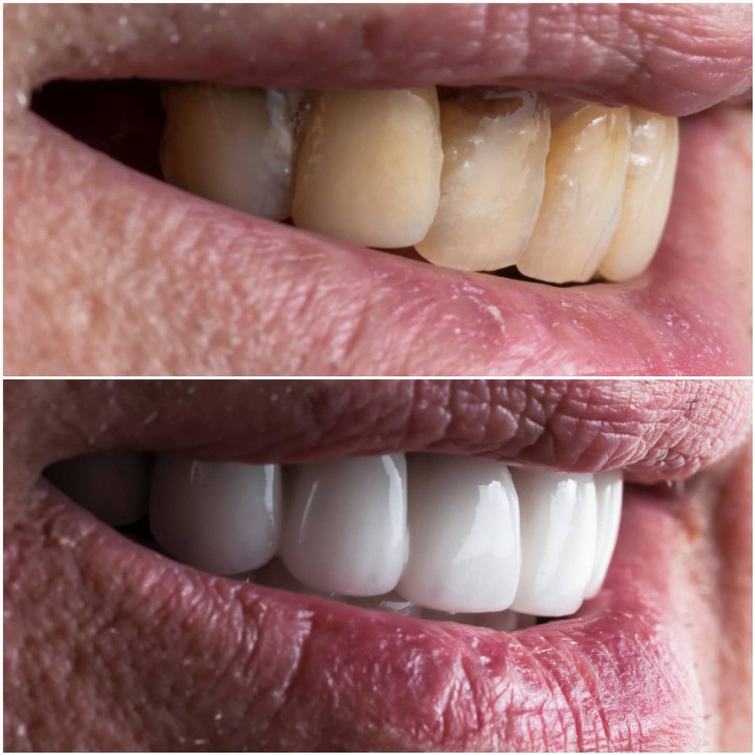 SMILE GALLERY - TLC Dental Wellness