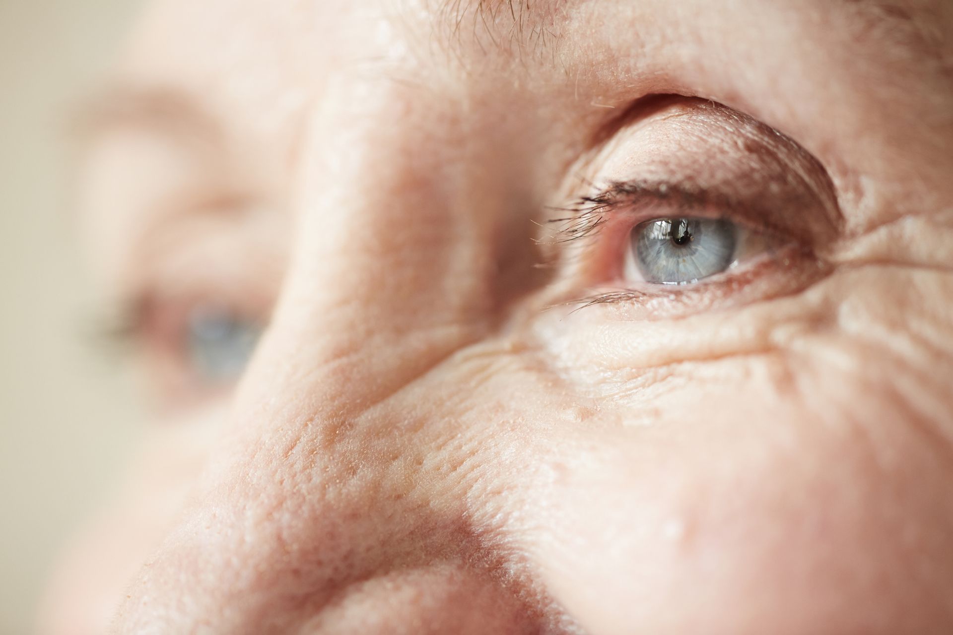 Top Eye Ageing Signs to Watch Out For