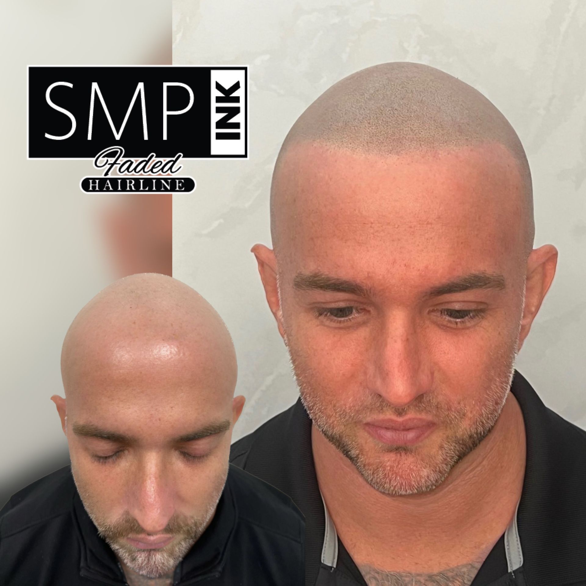 SMP Inc CDA before and after