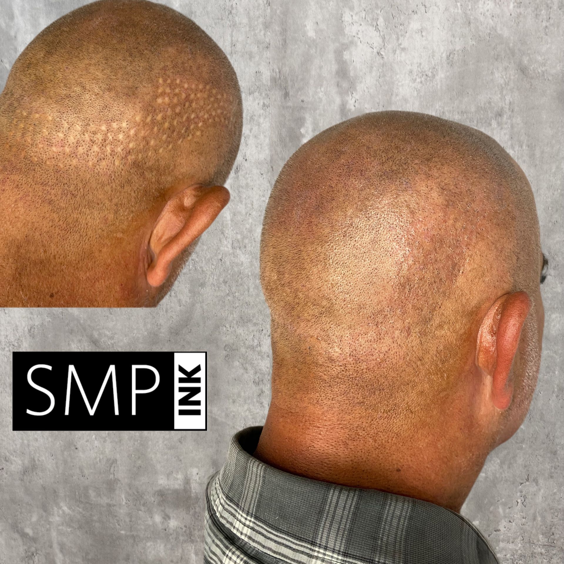 Client result of Results of SMP Correction fixing bad SMP results