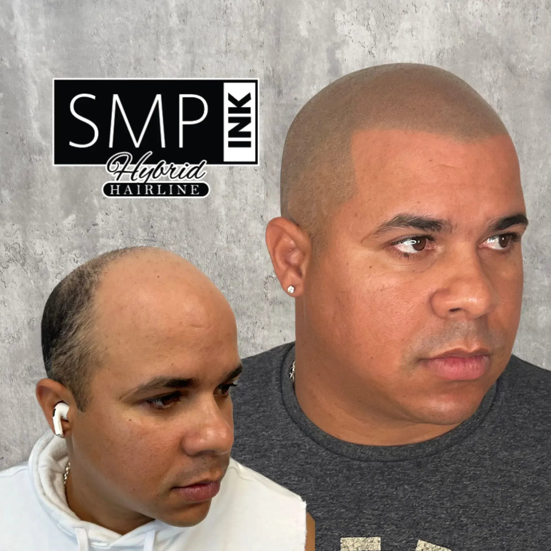 SMP Inc CDA before and after