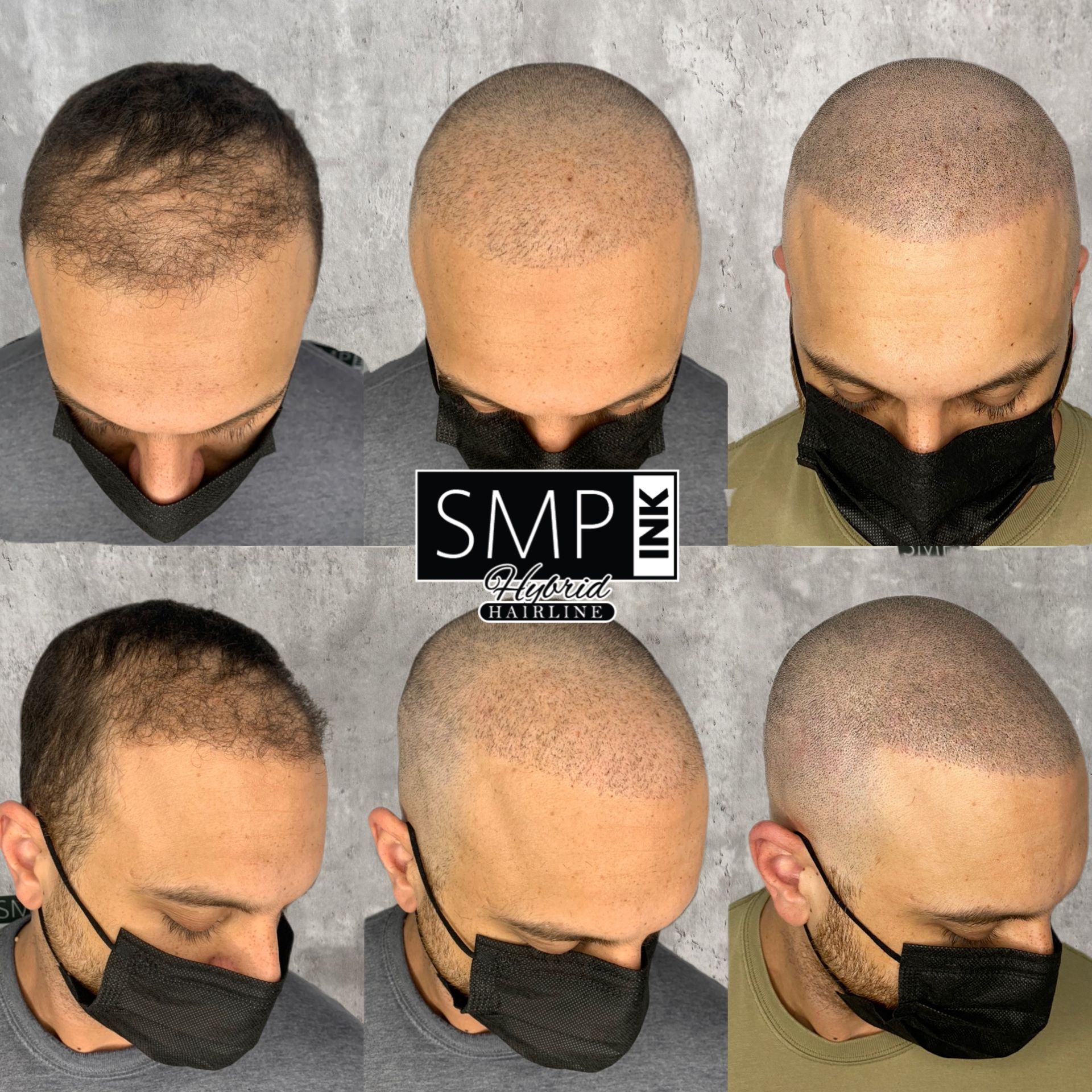 SMP Inc CDA before and after
