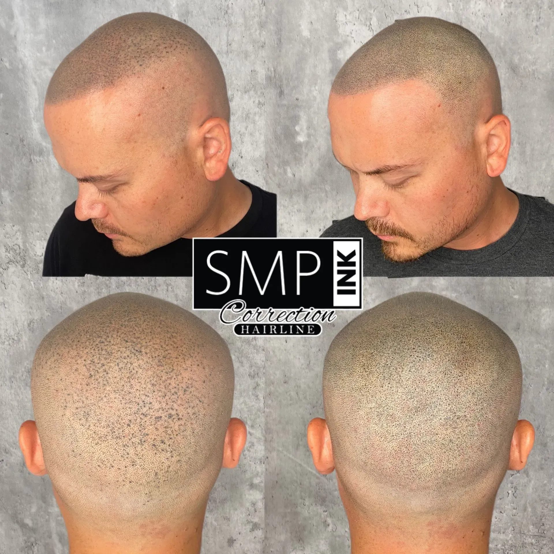 SMP Inc CDA before and after