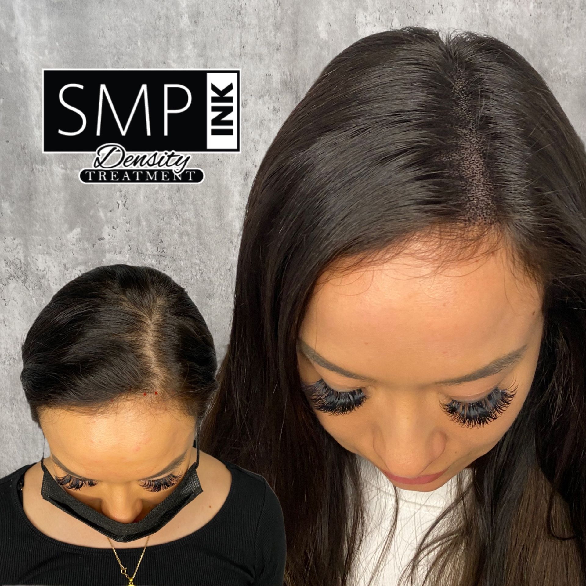 SMP | Trusted Scalp Micropigmentation Services in Scottsdale Arizona
