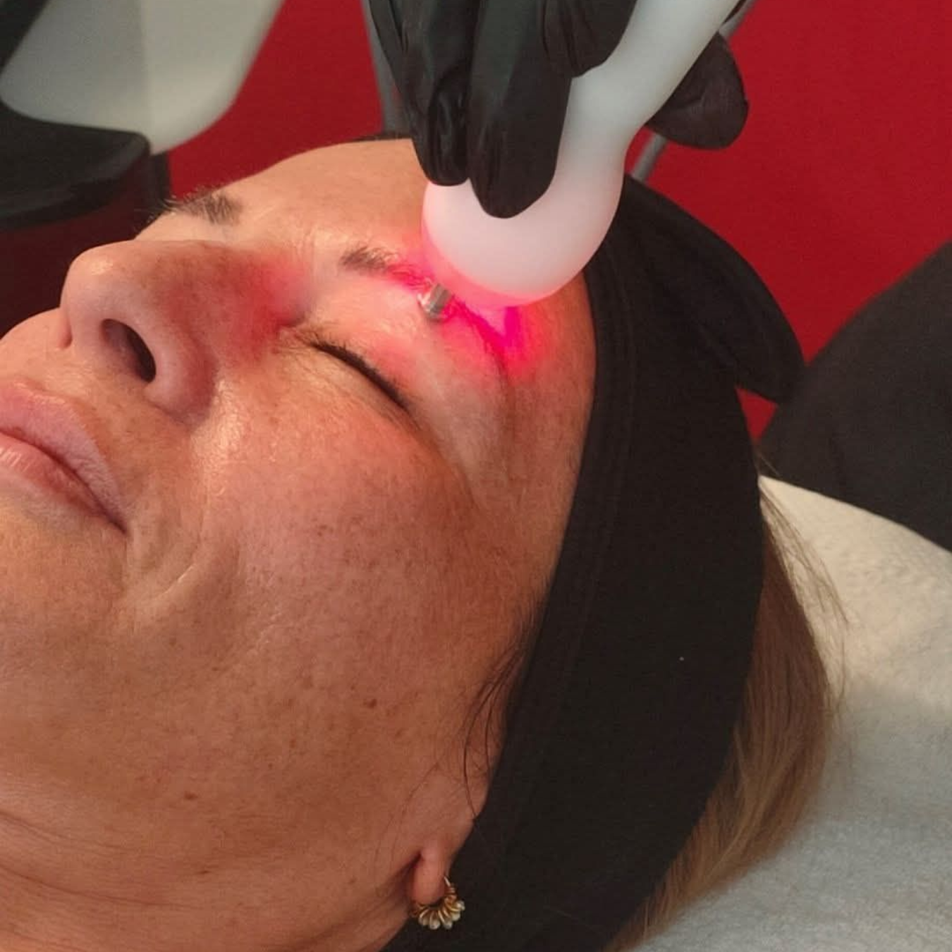 Une femme reçoit un traitement par ultrasons après une césarienne