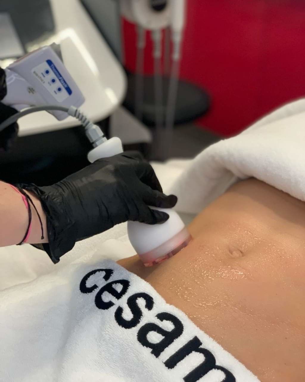 Une femme reçoit un traitement par ultrasons après une césarienne