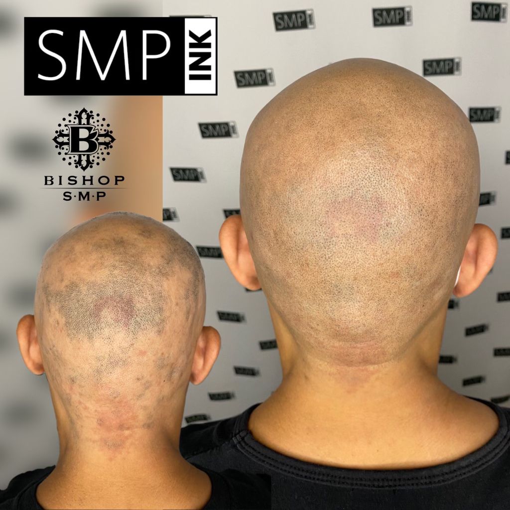 SMP Inc CDA before and after