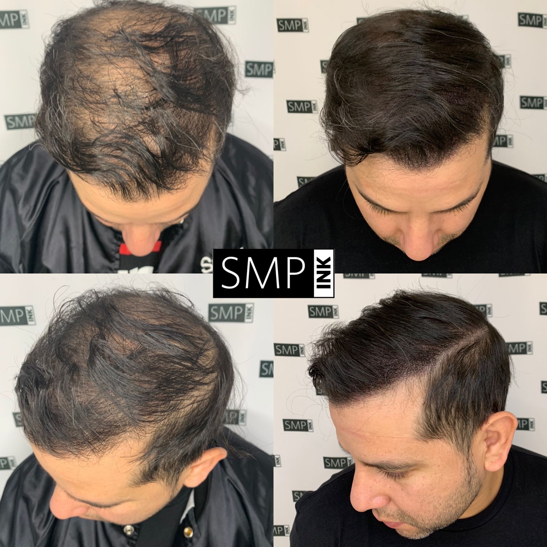 SMP Inc CDA before and after