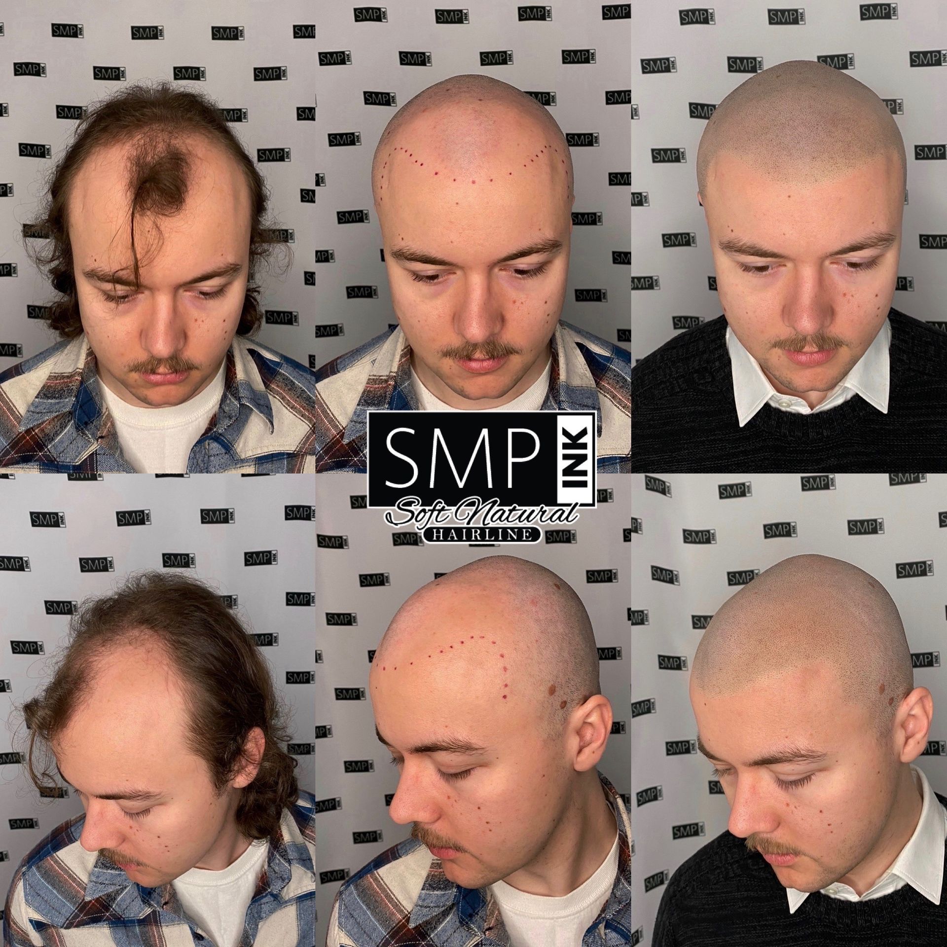SMP Inc CDA before and after