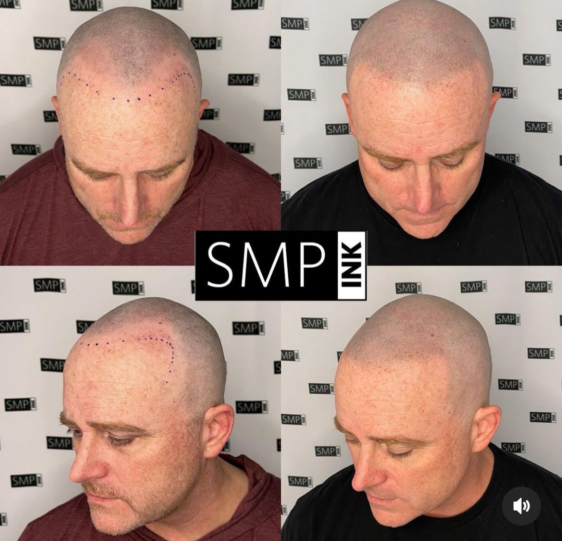 SMP Inc CDA before and after