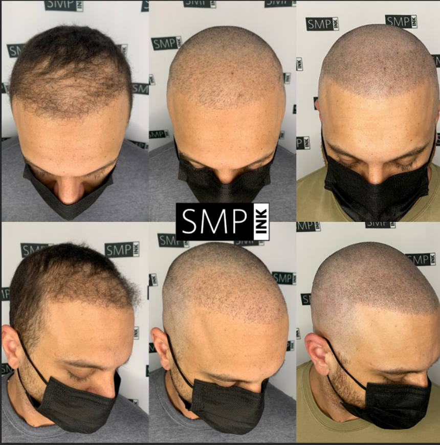 SMP Inc CDA before and after