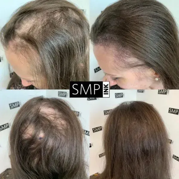 before and after receiving SMP from SMP INK