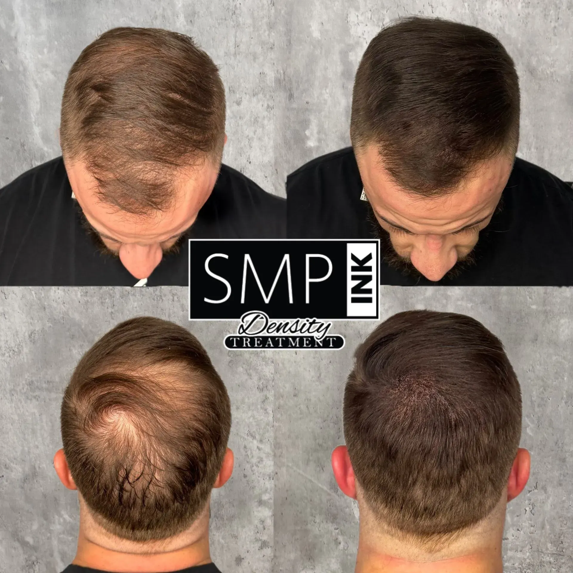 SMP Inc CDA before and after