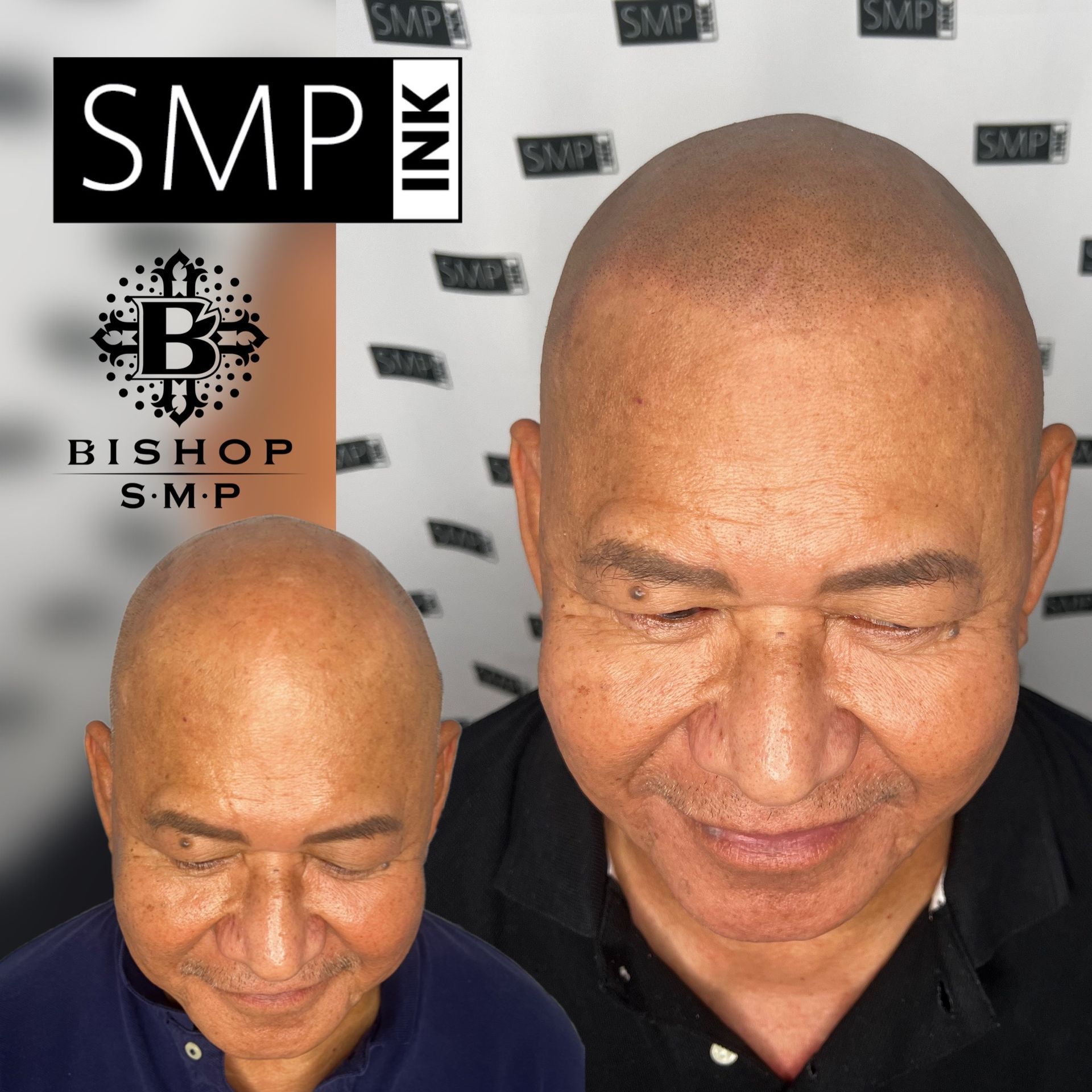 SMP Inc CDA before and after