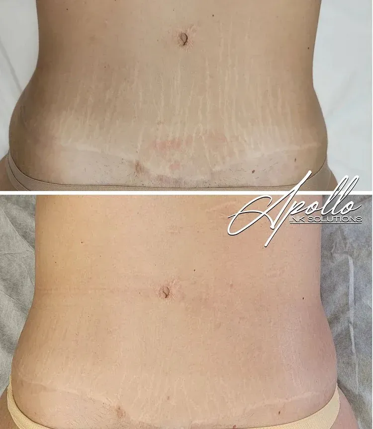 SMP Inc CDA before and after