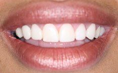 A close up of a woman 's mouth with white teeth and red lips.