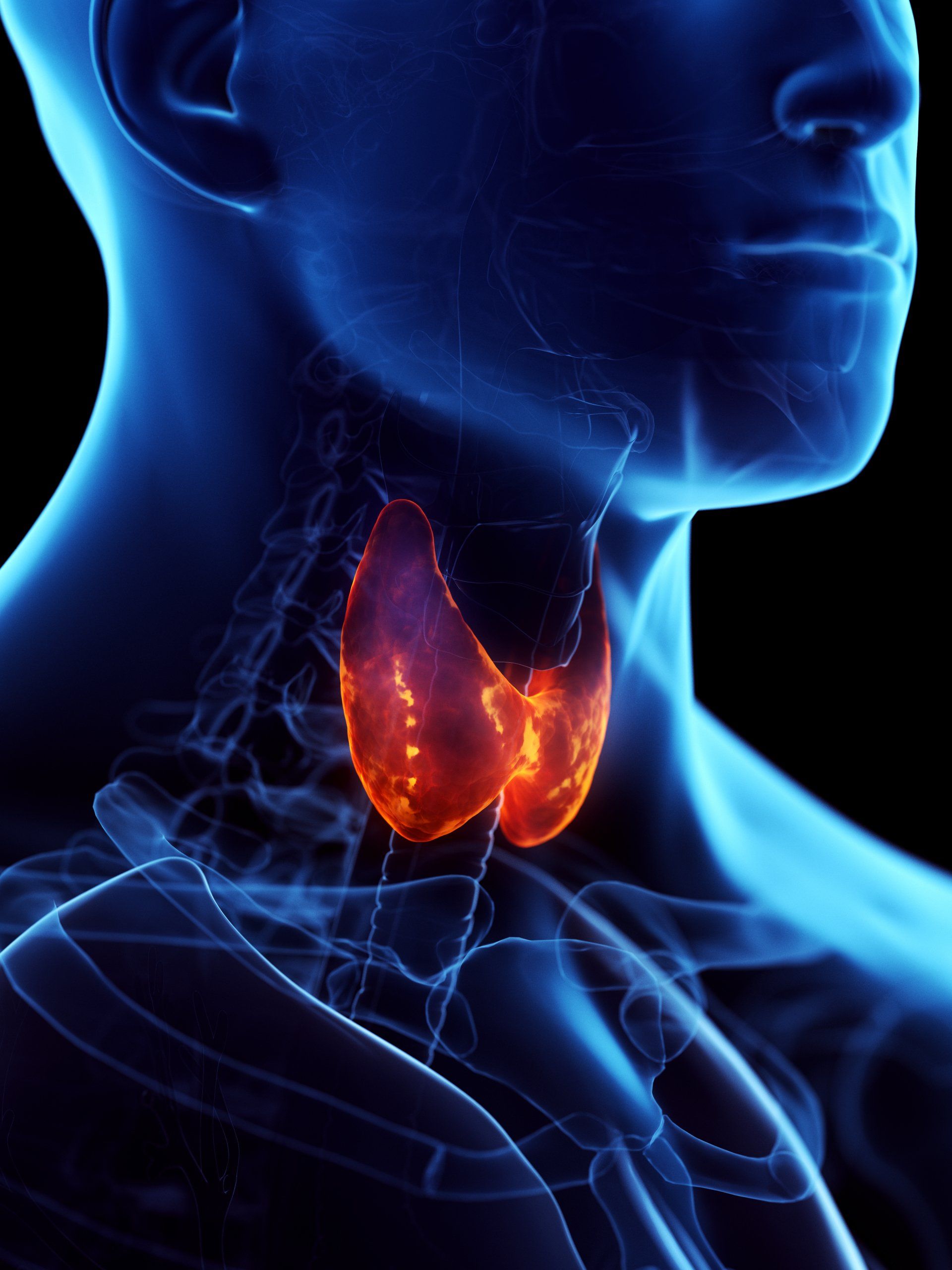 thyroid-disorder
