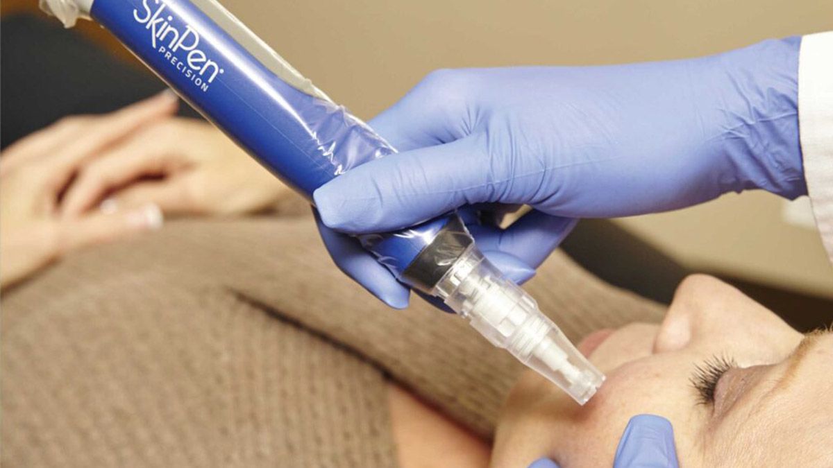 A woman is getting a skin pen treatment on her face