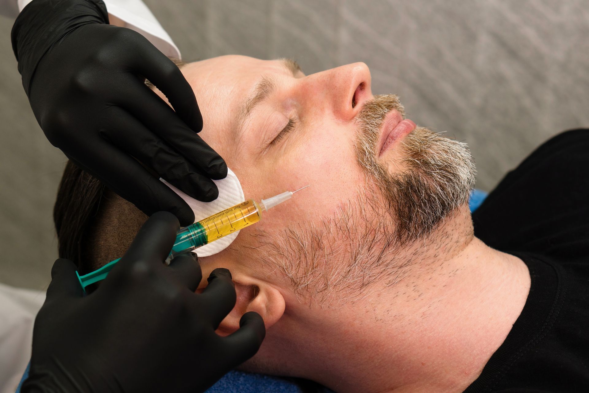 Gloved hands perform an injectable facial treatment on a person’s cheek using a syringe with a yellow substance.