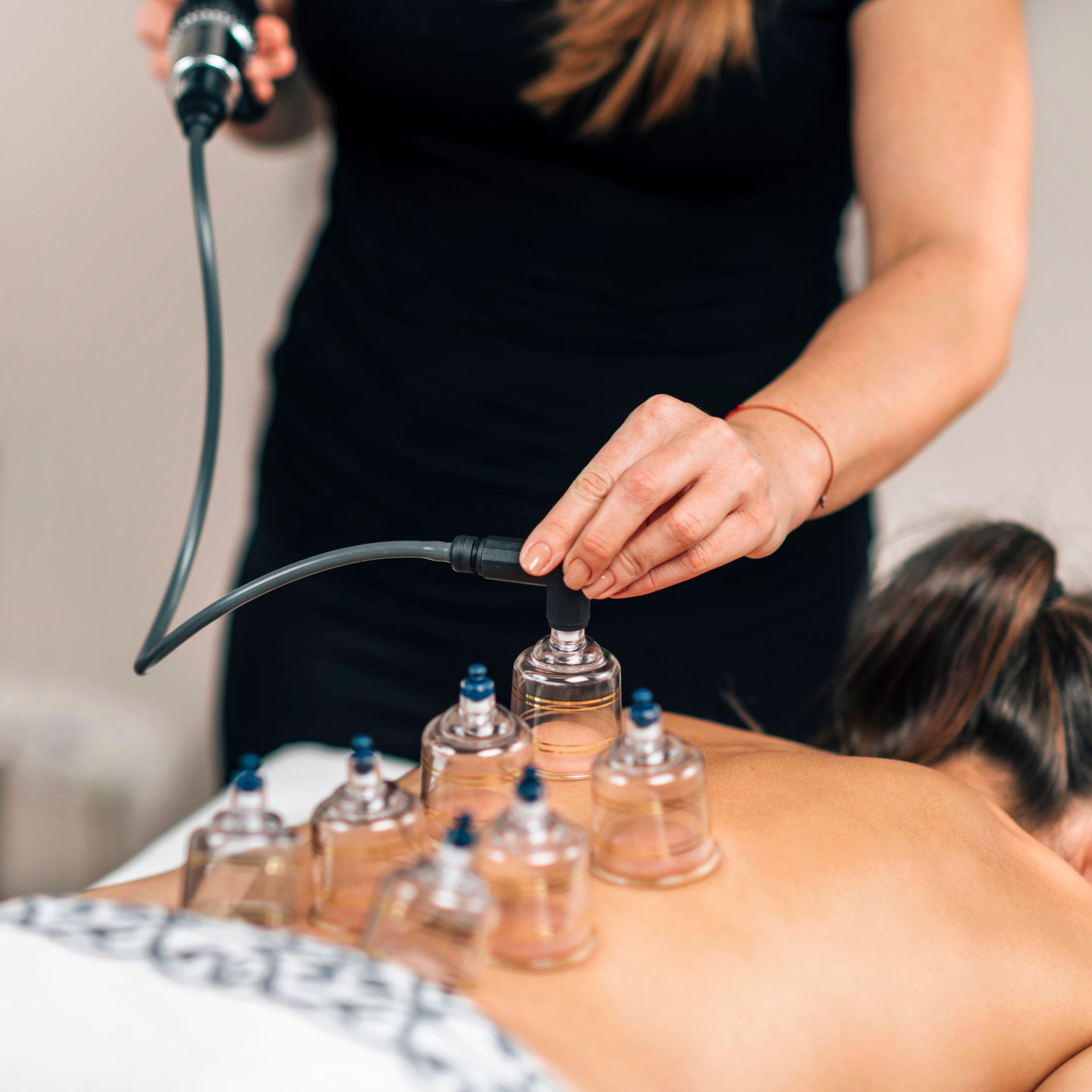 A woman is getting a cupping treatment on her back.