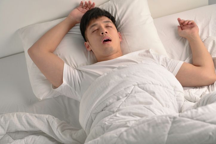 Man sleeping in bed, mouth open, arms raised, under white covers.