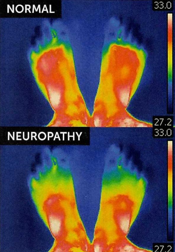 Person holding their ankle, a red area indicating pain, against a white background.