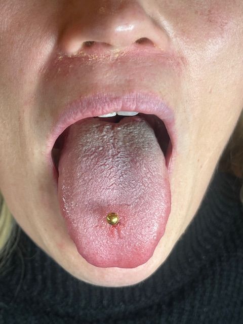 Een close-up van een open mond, waarop een tong te zien is met een metalen piercing in het midden.