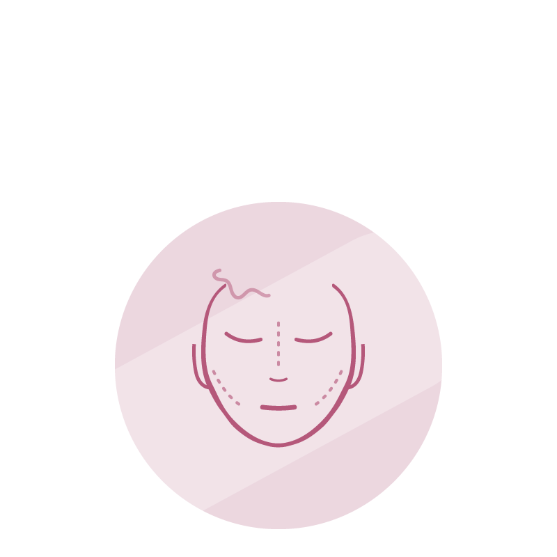 Cirugía Facial