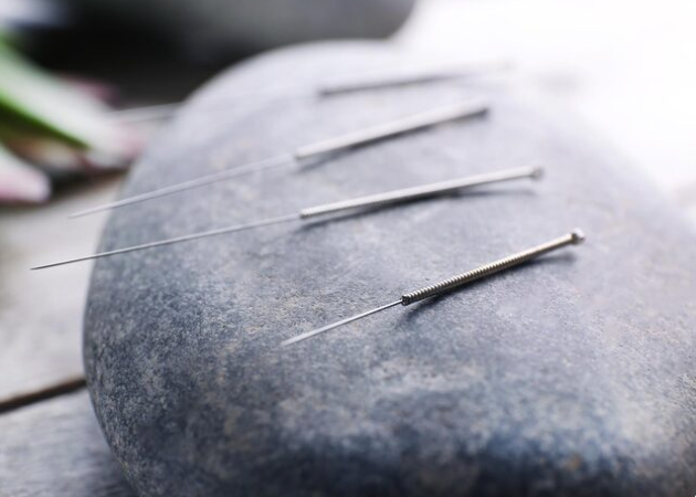 Acupuncture Needles Being Applied to Someone — Alchemy Wellness Centre In Bangalow, NSW