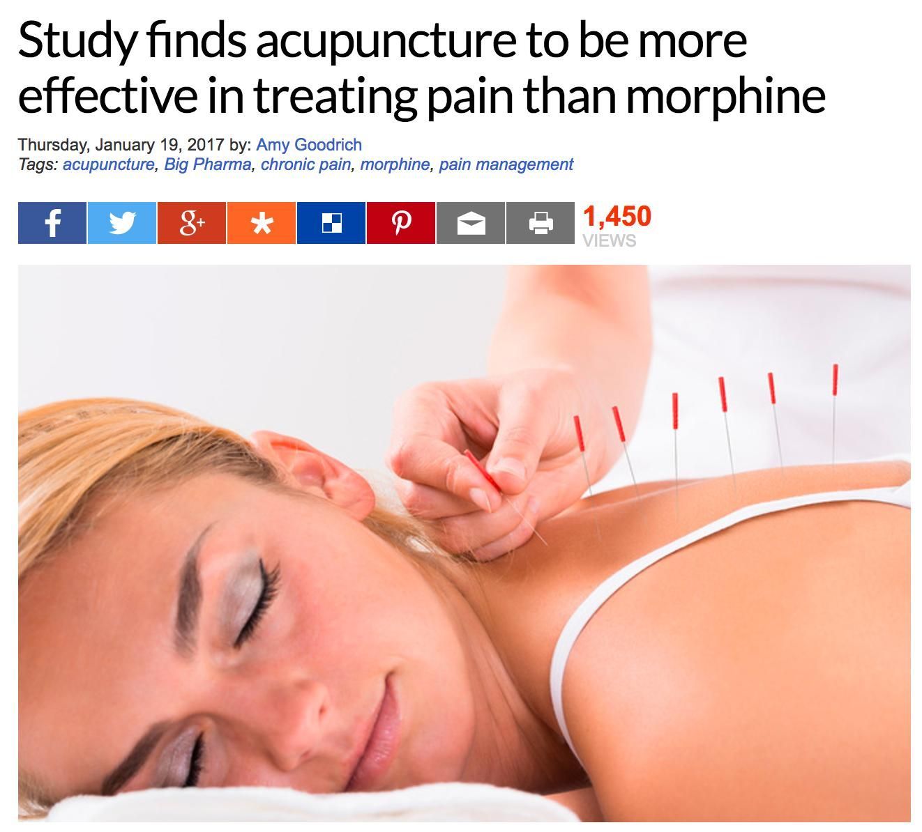 A Woman Is Getting Acupuncture Treatment on Her Back — Alchemy Wellness Centre In Bangalow, NSW
