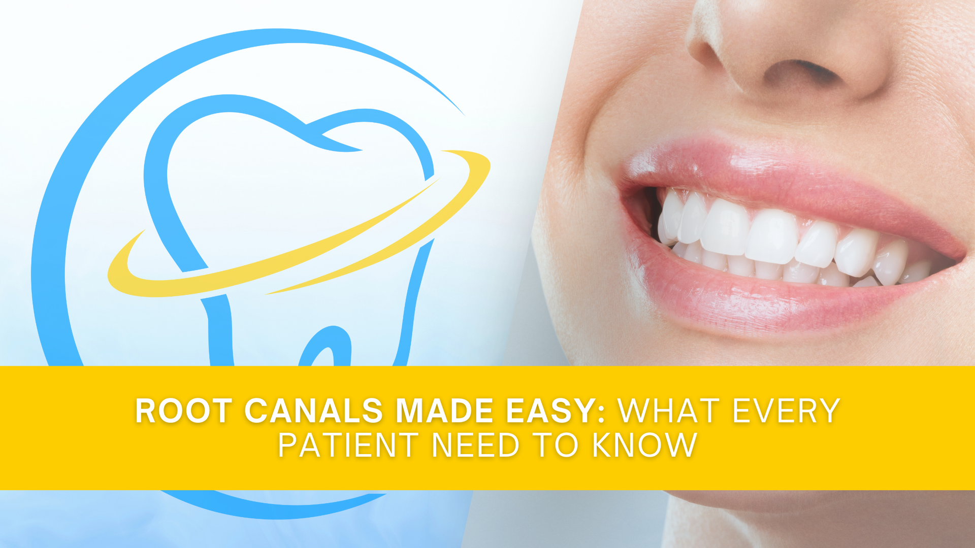 A close up of a woman 's smile with the words root canals made easy what every patient need to know