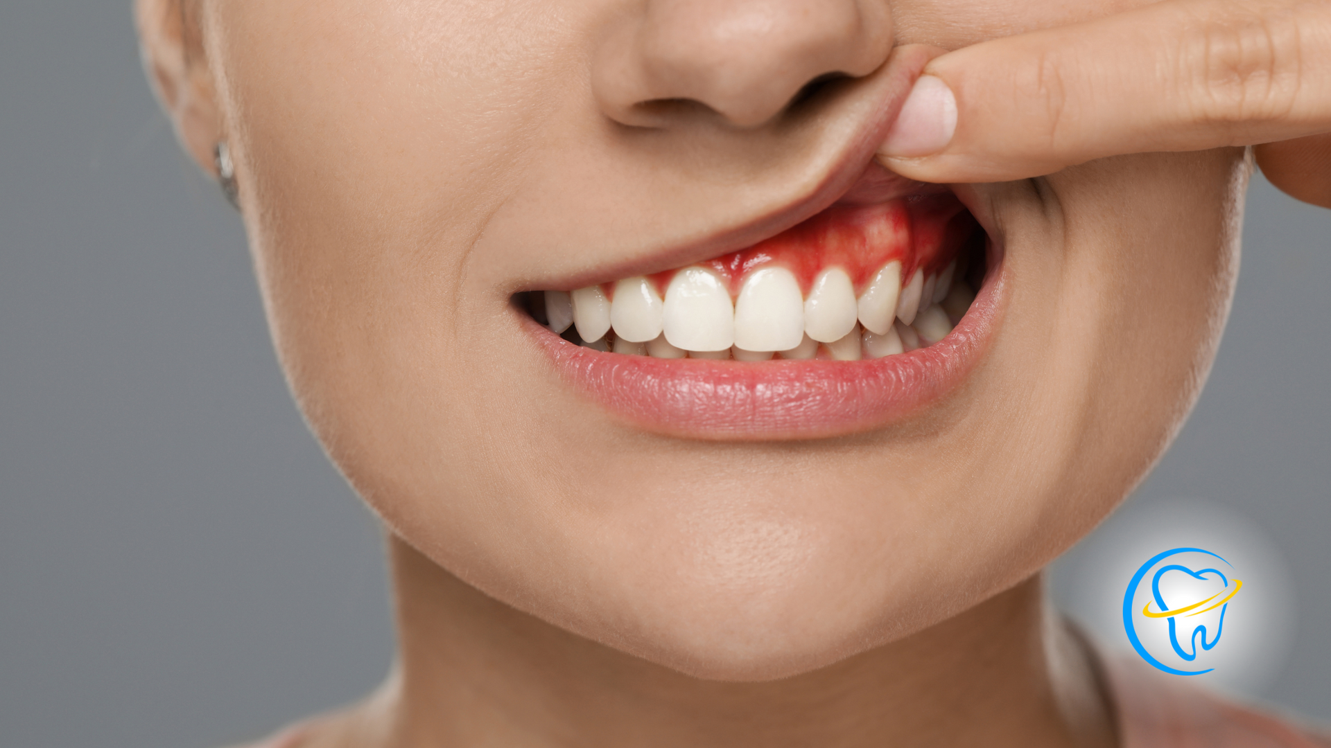 A close up of a woman 's mouth with a toothache.