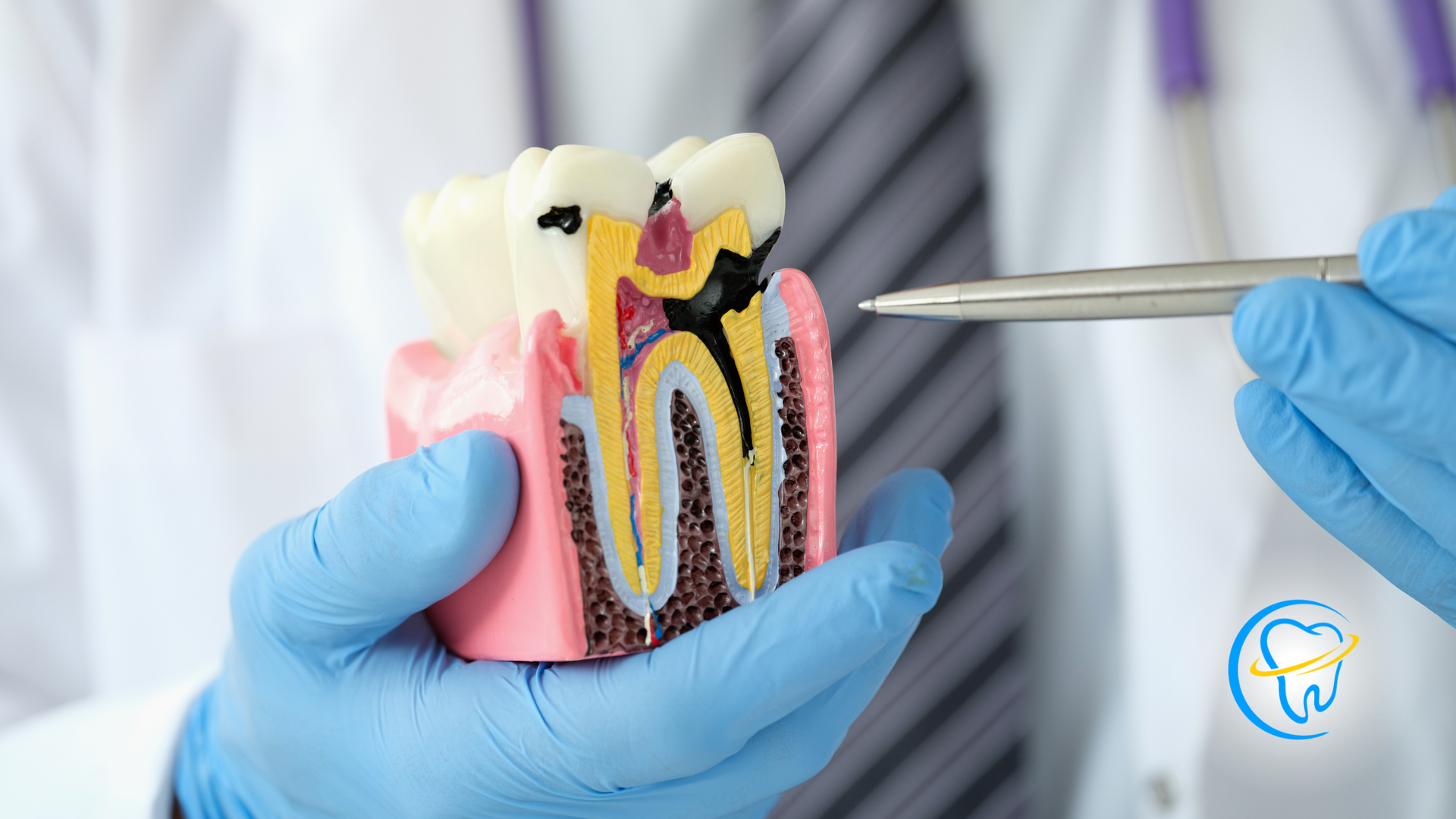 A dentist is holding a model of a tooth with a needle in it.