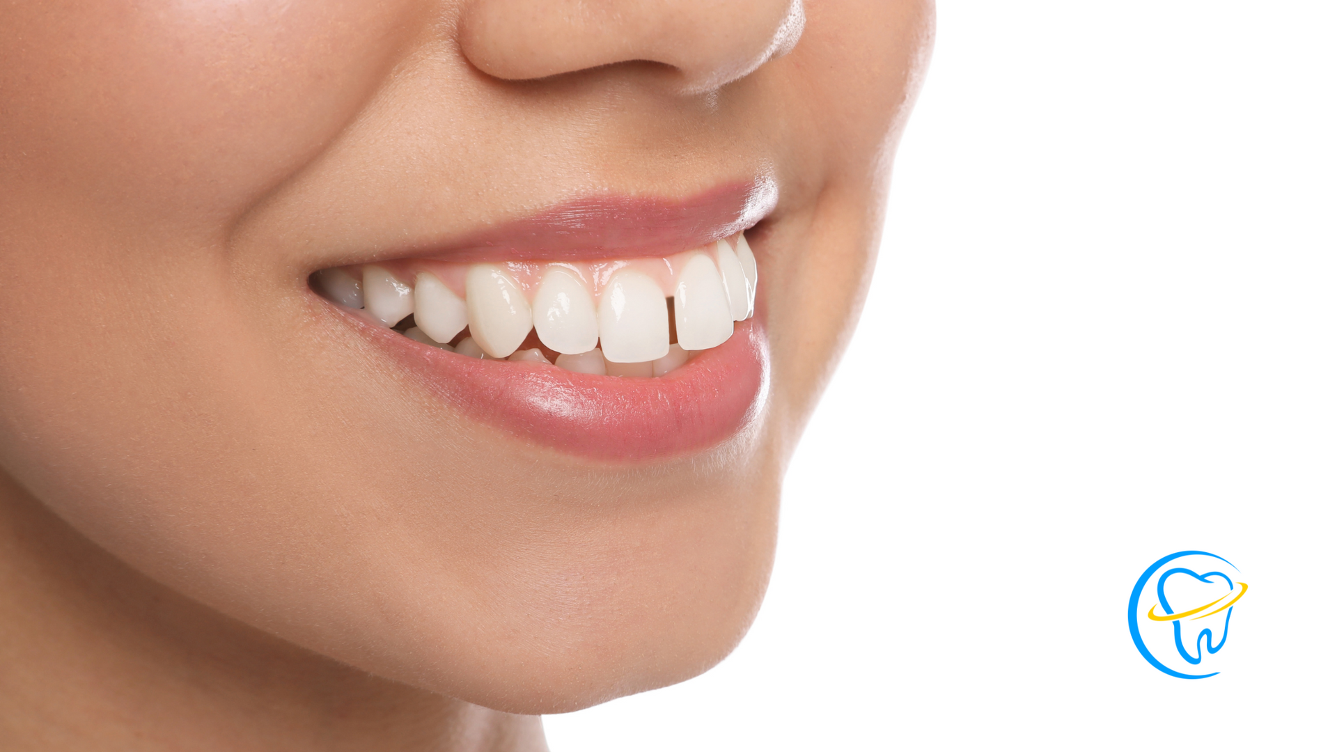 A close up of a woman 's smile with white teeth.