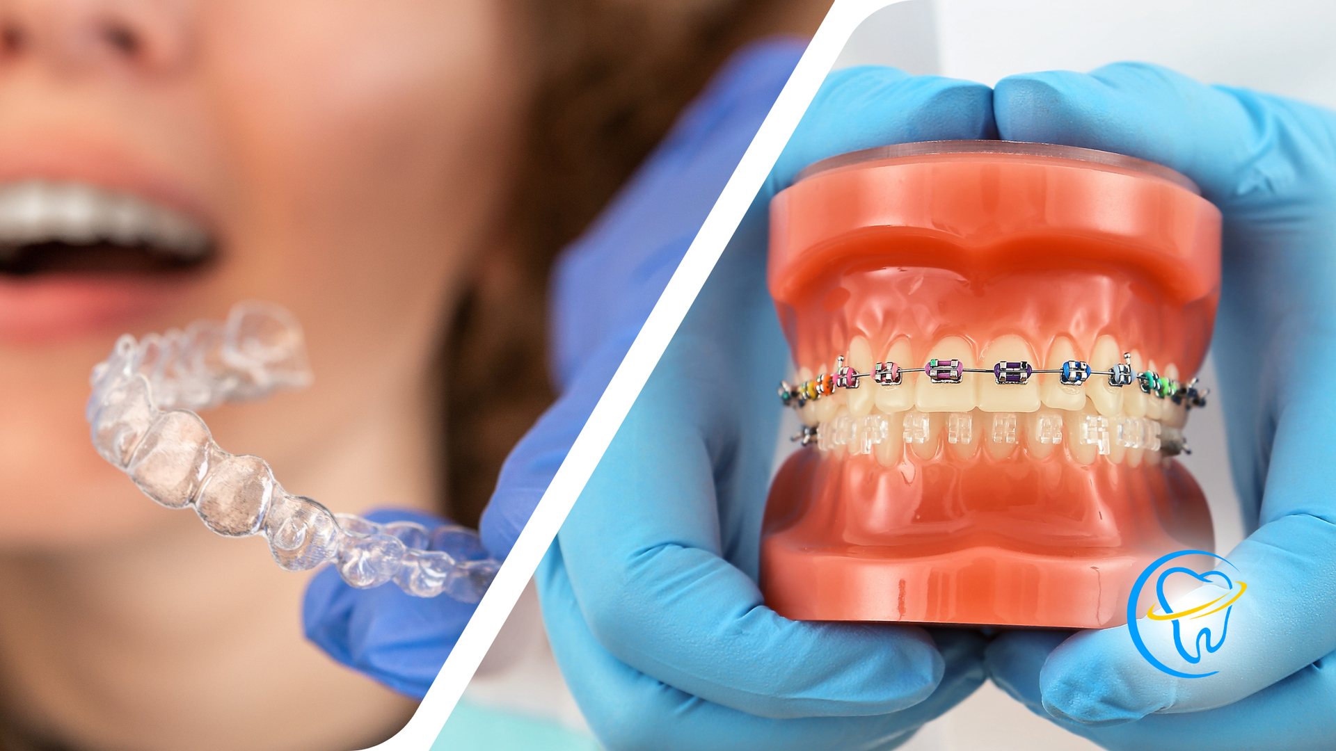 A woman is getting braces and a dentist is holding a model of her teeth.