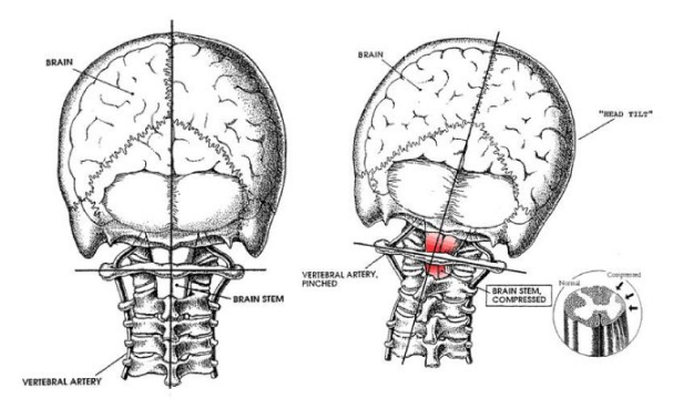 Dr. Bill Moss is a Chiropractor Serving Reading, Wyomissing, and Berks County, PA.