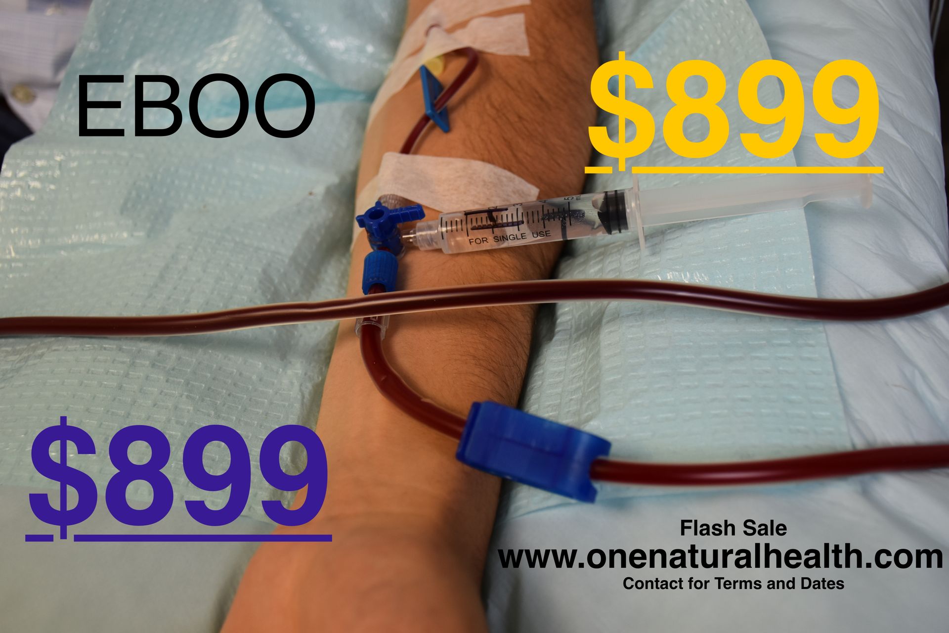 EBOO ozone therapy price